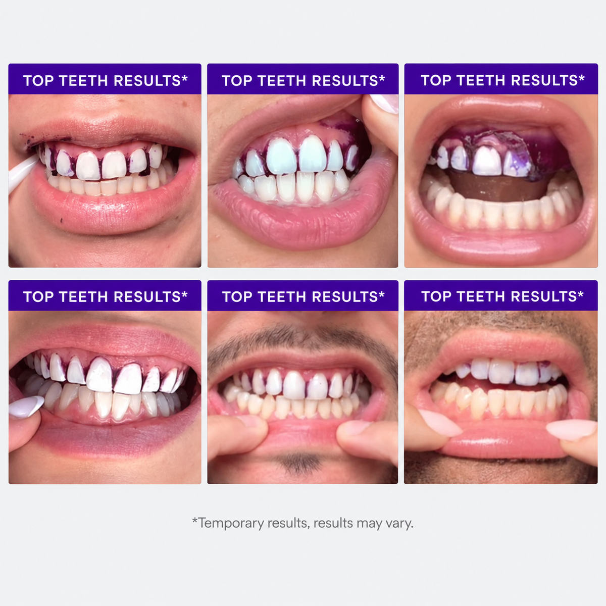 Enamelle Whitening Strips