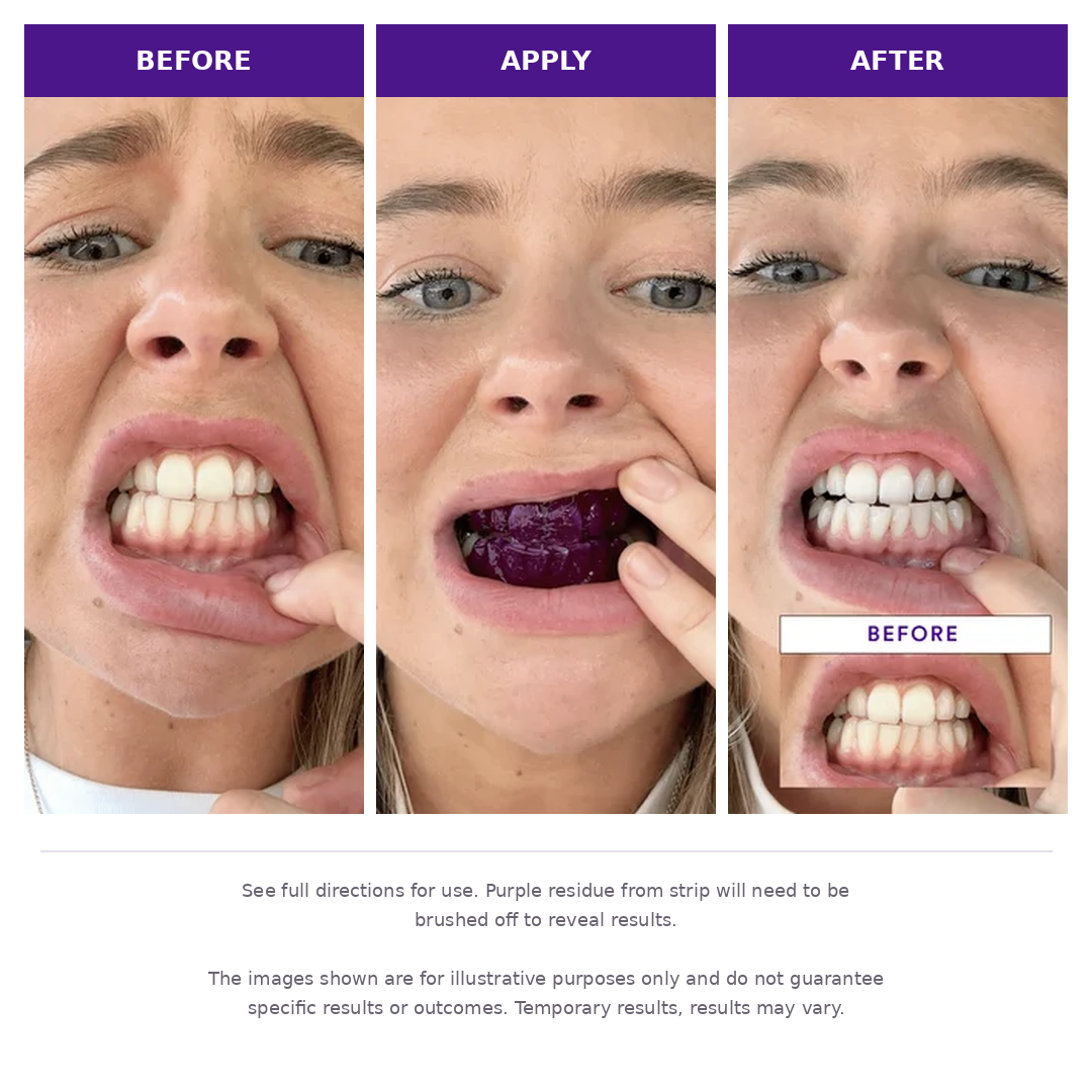 Enamelle Whitening Strips